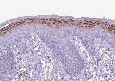 Immunohistochemistry-Paraffin: CLEC-2A Antibody [NBP2-14641]