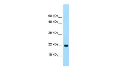 Western Blot: CLEC-2A Antibody [NBP3-10701]