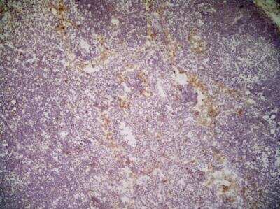 Immunohistochemistry: CLEC10A/CD301 Antibody (ER-MP23) - BSA Free [NB100-64874]