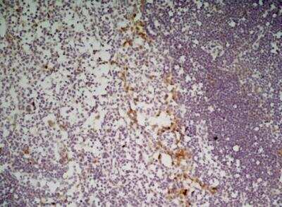 Immunohistochemistry: CLEC10A/CD301 Antibody (ER-MP23) - BSA Free [NB100-64874]