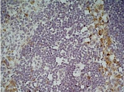 Immunohistochemistry: CLEC10A/CD301 Antibody (ER-MP23) - BSA Free [NB100-64874]