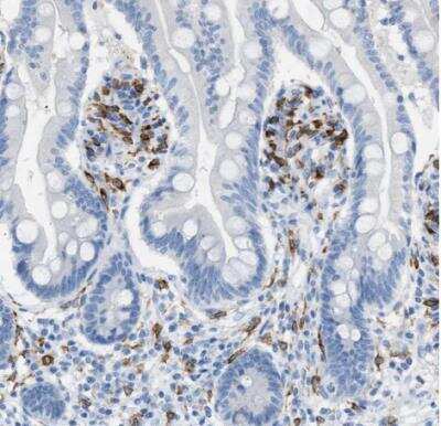 Immunohistochemistry-Paraffin: CLEC10A/CD301 Antibody [NBP1-84591]