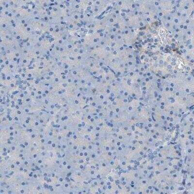 Immunohistochemistry-Paraffin: CLEC10A/CD301 Antibody [NBP1-84591]