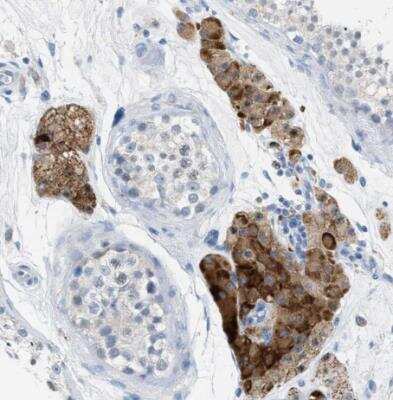 Immunohistochemistry-Paraffin: CLEC10A/CD301 Antibody [NBP1-84591]