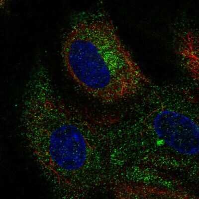 Immunocytochemistry/ Immunofluorescence: CLEC14A Antibody [NBP2-56335]