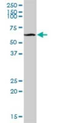 Western Blot: CLEC14A Antibody [H00161198-B01P]