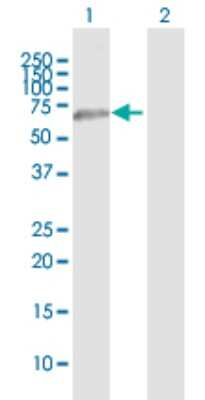 Western Blot: CLEC14A Antibody [H00161198-B01P]