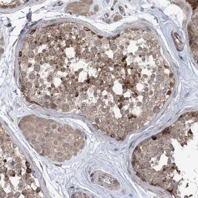 Immunohistochemistry-Paraffin: CLEC16A Antibody [NBP1-81806]