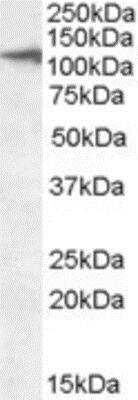 Western Blot: CLEC16A Antibody [NBP1-36948]