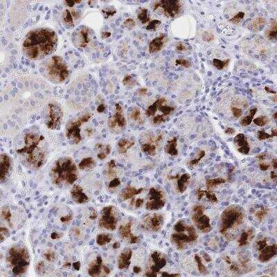 Immunohistochemistry: CLEC18B Antibody [NBP2-46765]