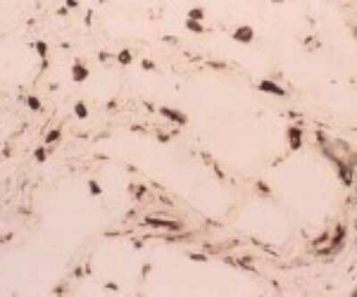 Immunohistochemistry: CLEC18C Antibody (118F2.02) [DDX0381P-100]