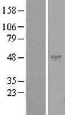 Western Blot: CLEC18C Overexpression Lysate [NBL1-13068]