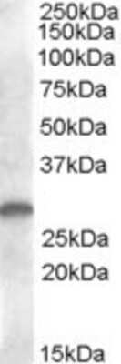 Western Blot: CLEC-2/CLEC-1B Antibody [NB100-93458]