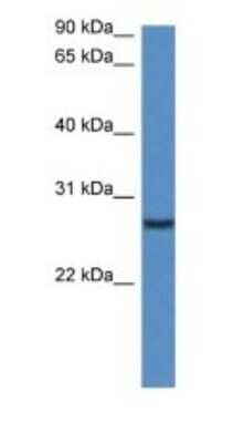 Western Blot: CLEC-2/CLEC-1B Antibody [NBP1-79203]