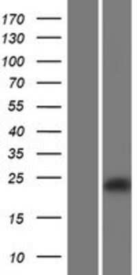 Western Blot: OCIL/CLEC2d Overexpression Lysate [NBP2-08866]