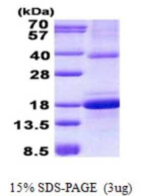 SDS-PAGE: Recombinant Human OCIL/CLEC2d His Protein [NBP2-22966]