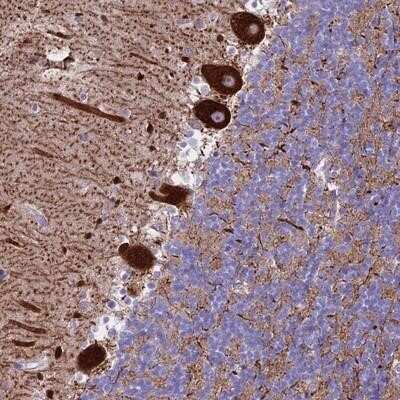 Immunohistochemistry-Paraffin: CLEC2L Antibody [NBP1-93861]