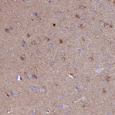 Immunohistochemistry-Paraffin: CLEC2L Antibody [NBP1-93861]