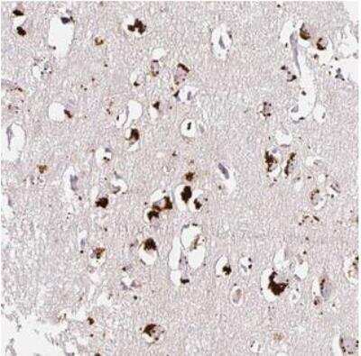 Immunohistochemistry-Paraffin: CLEC3A Antibody [NBP2-30595]