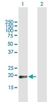 Western Blot: CLEC3A Antibody [H00010143-B01P]