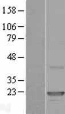 Western Blot: CLEC3A Overexpression Lysate [NBP2-07708]