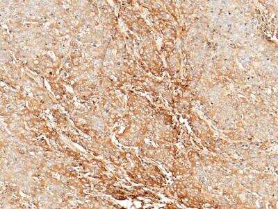 Immunohistochemistry-Paraffin: CLEC3B/Tetranectin Antibody (006) [NBP2-90147]