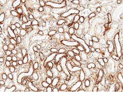 Immunohistochemistry-Paraffin: CLEC3B/Tetranectin Antibody (006) [NBP2-90147]