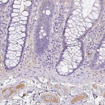 Immunohistochemistry-Paraffin: CLEC3B/Tetranectin Antibody [NBP2-38222]