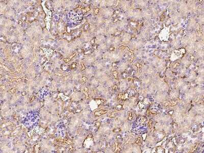 Immunohistochemistry-Paraffin: CLEC3B/Tetranectin Antibody [NBP2-98344]