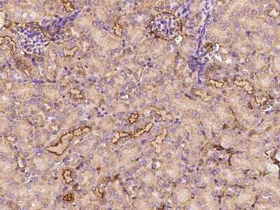 Immunohistochemistry-Paraffin: CLEC3B/Tetranectin Antibody [NBP2-98345]