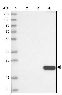 Western Blot: CLEC3B/Tetranectin Antibody [NBP2-38222]