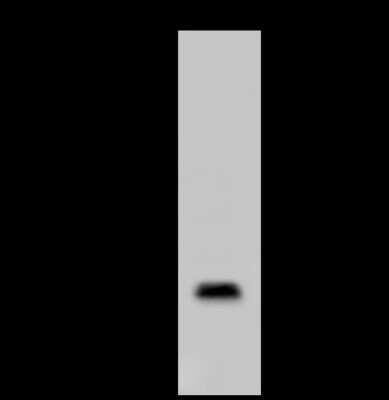 Western Blot: CLEC3B/Tetranectin Antibody [NBP2-98345]