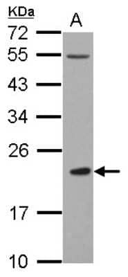 Western Blot: DCIR/CLEC4A Antibody [NBP2-15916]