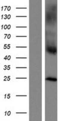 Western Blot: DCIR/CLEC4A Overexpression Lysate [NBP2-04351]