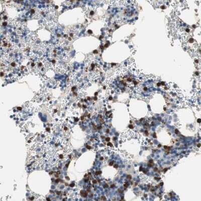 Immunohistochemistry-Paraffin: CLEC4D/CLECSF8 Antibody [NBP1-84445]