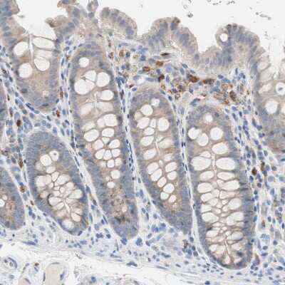 Immunohistochemistry-Paraffin: CLEC4D/CLECSF8 Antibody [NBP1-84445]