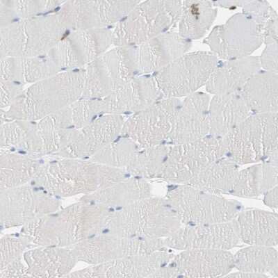 Immunohistochemistry-Paraffin: CLEC4D/CLECSF8 Antibody [NBP1-84445]