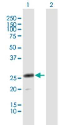 Western Blot: CLEC4D/CLECSF8 Antibody [H00338339-B01P]