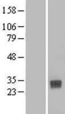 Western Blot: CLEC4D/CLECSF8 Overexpression Lysate [NBL1-09260]