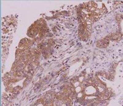 Immunohistochemistry-Paraffin: CLEC4E Antibody (16E3) - BSA Free [NBP1-49311]