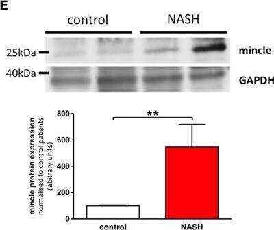 Western Blot: CLEC4E Antibody (16E3)BSA Free [NBP1-49311]