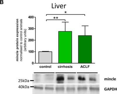 Western Blot: CLEC4E Antibody (16E3)BSA Free [NBP1-49311]