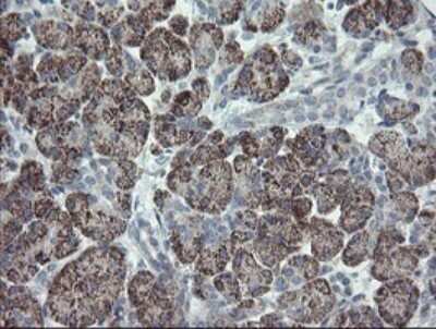 Immunohistochemistry: CLEC4E Antibody (OTI2A8) [NBP2-45629]