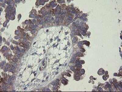 Immunohistochemistry: CLEC4E Antibody (OTI2A8) [NBP2-45629]