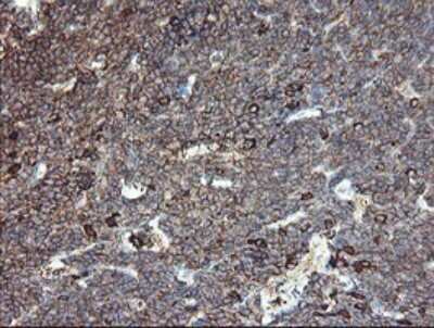 Immunohistochemistry: CLEC4E Antibody (OTI2A8) [NBP2-45629]