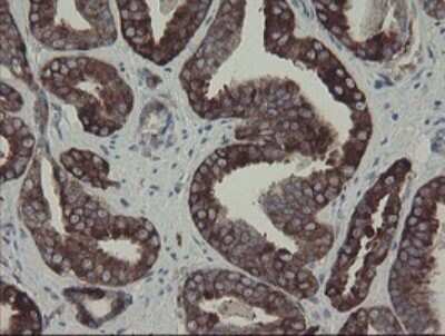 Immunohistochemistry: CLEC4E Antibody (OTI2A8) [NBP2-45629]