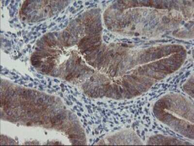 Immunohistochemistry: CLEC4E Antibody (OTI2A8) [NBP2-45629]
