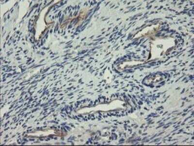 Immunohistochemistry: CLEC4E Antibody (OTI2A8) [NBP2-45629]