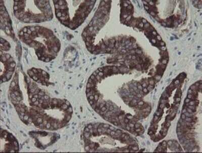 Immunohistochemistry: CLEC4E Antibody (OTI2A8) - Azide and BSA Free [NBP2-71793]