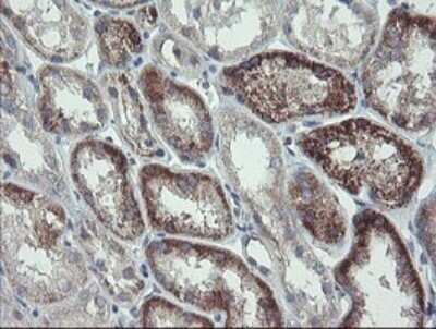 Immunohistochemistry: CLEC4E Antibody (OTI2A8) - Azide and BSA Free [NBP2-71793]